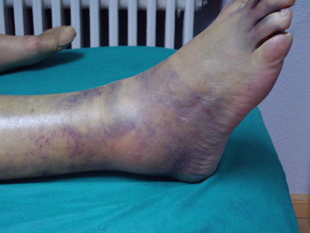 7cf1dc_787e009170de41dca9eca5f02c531fe4~mv2_d_3072_2304_s_2